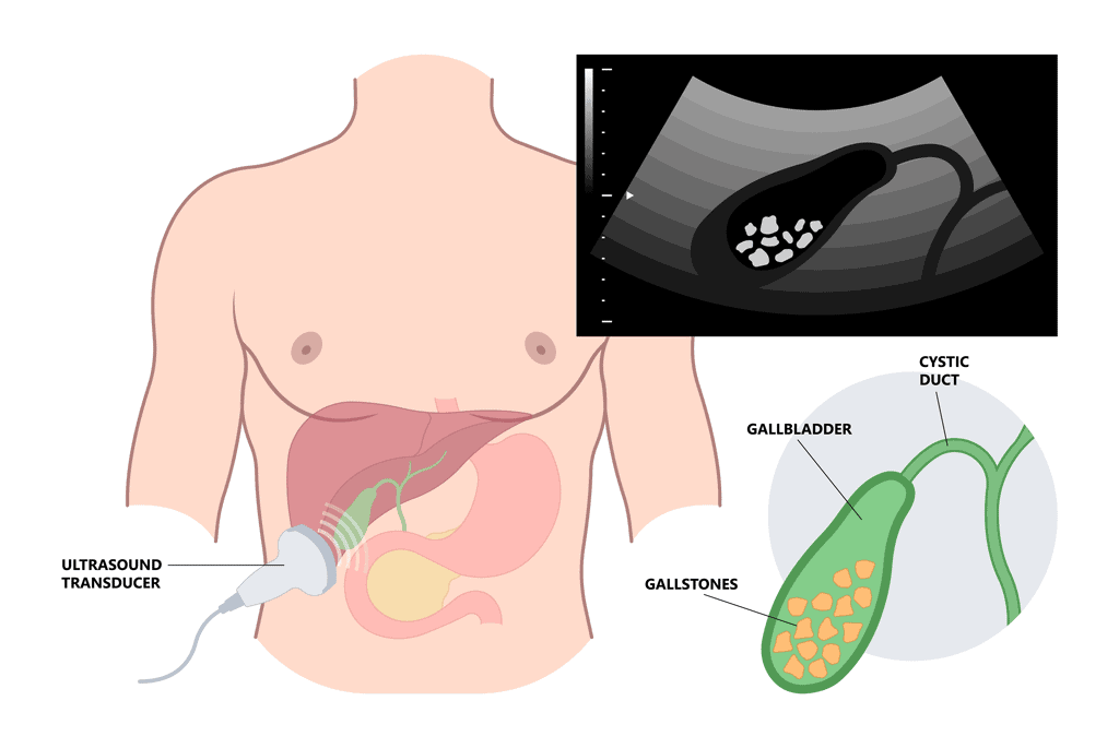 ultrasound hepatobiliary system