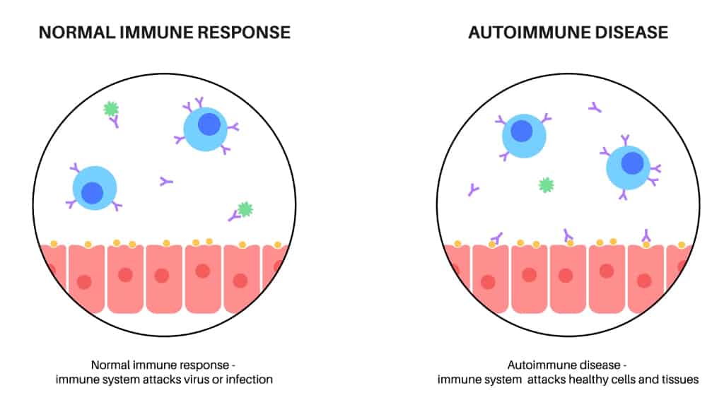 Normal-immune-response-vs-autoimmune-disease-respond