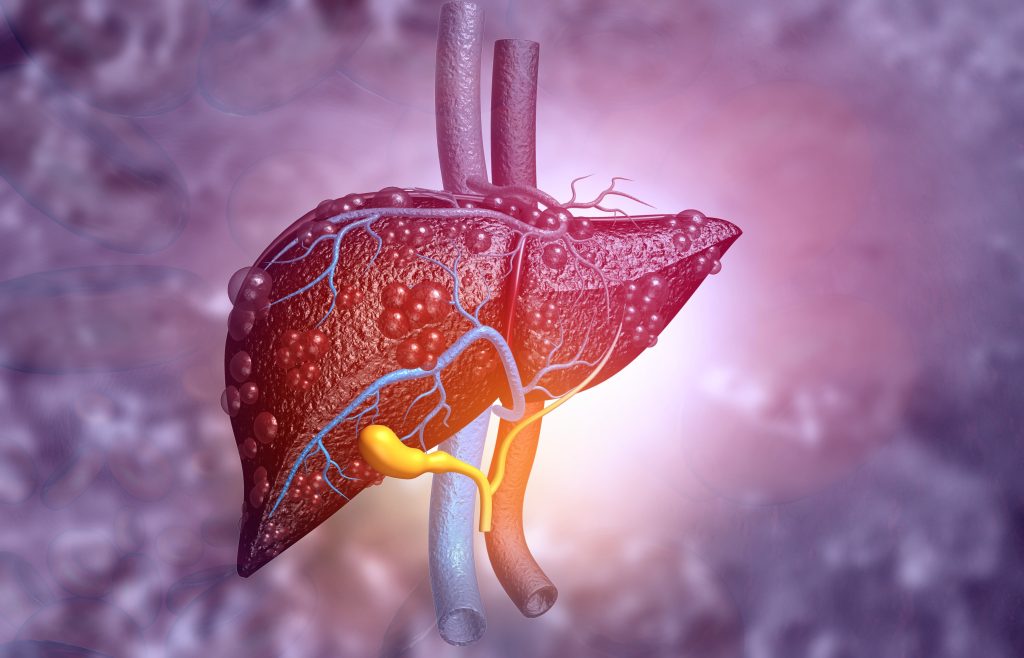 liver fibrosis vs cirrhosis