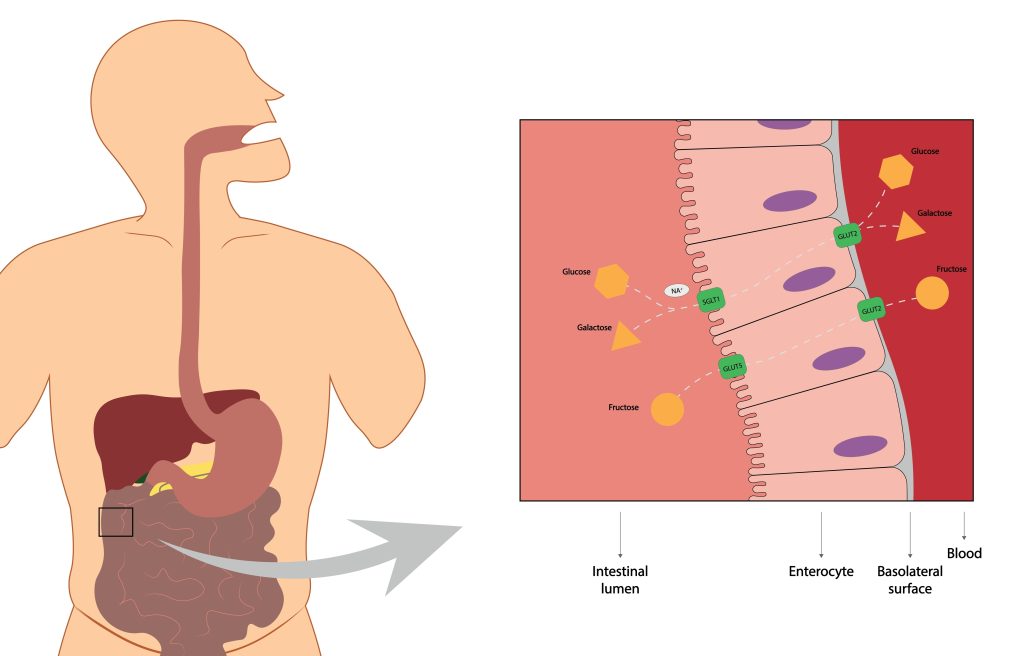 What are the symptoms and types of Malabsorption?