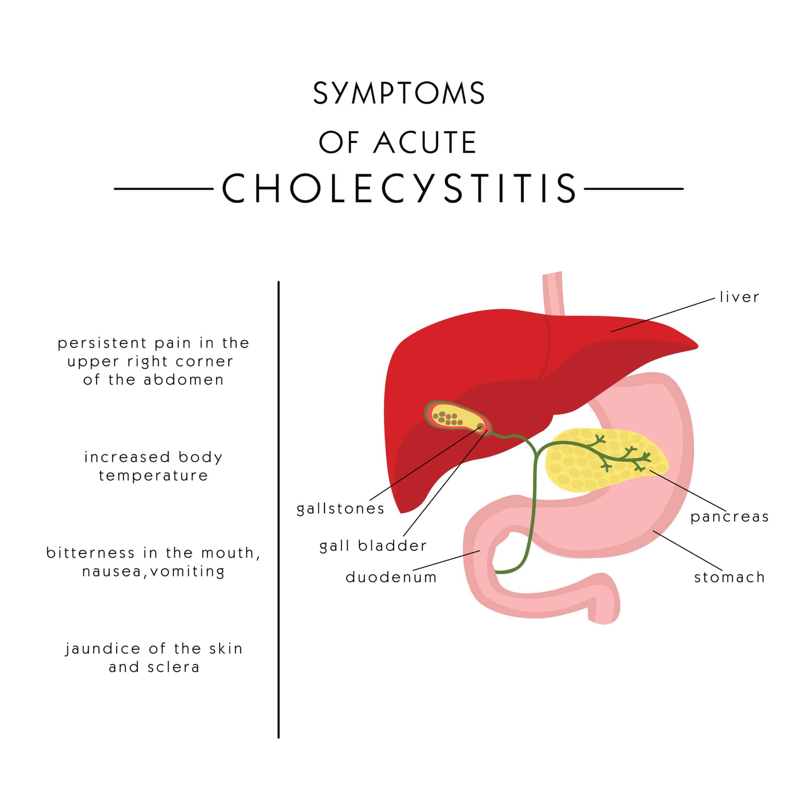 Illustration of Symptoms of Acute Cholecystitis