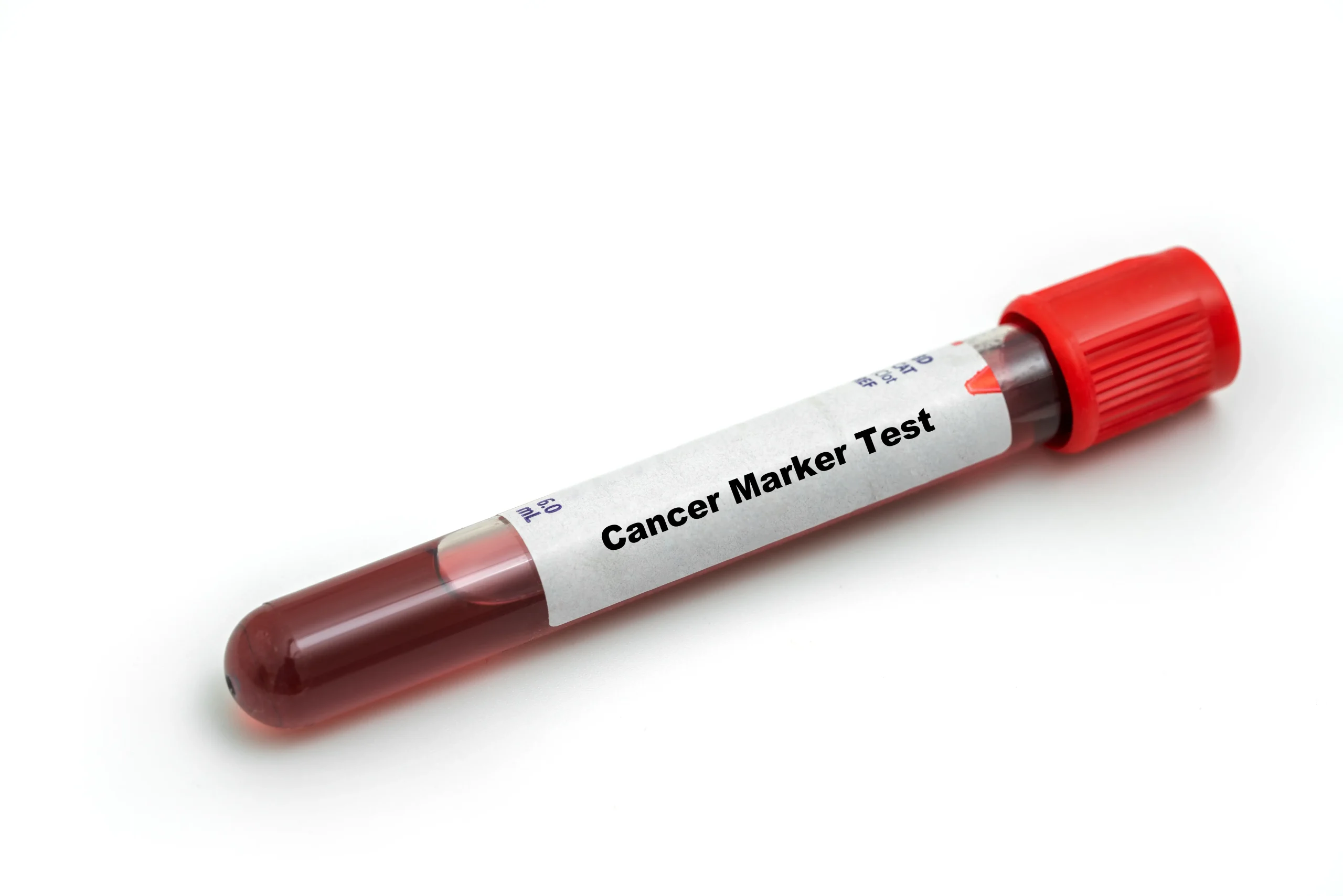 Tumour Marker Test